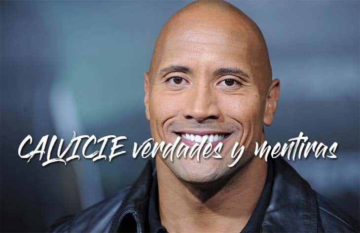 Calvicie verdades y mentiras
