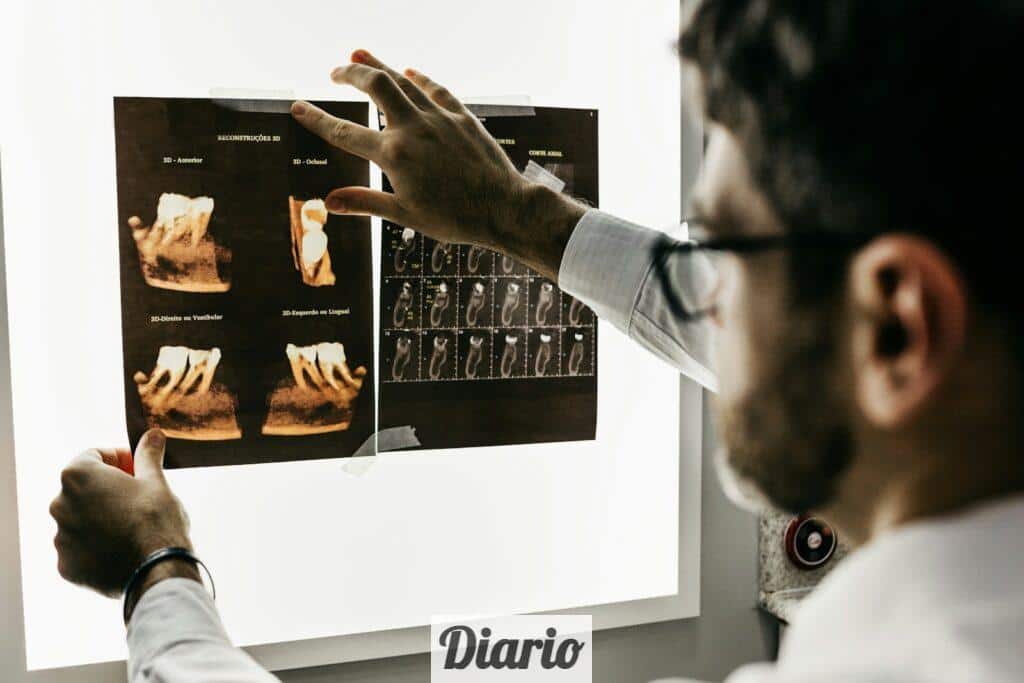 Top 3 Clínicas dentales para ponerte carillas dentales en Málaga