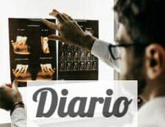 Top 3 Clínicas dentales para ponerte carillas dentales en Málaga