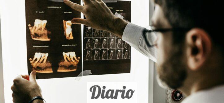 Top 3 Clínicas dentales para ponerte carillas dentales en Málaga