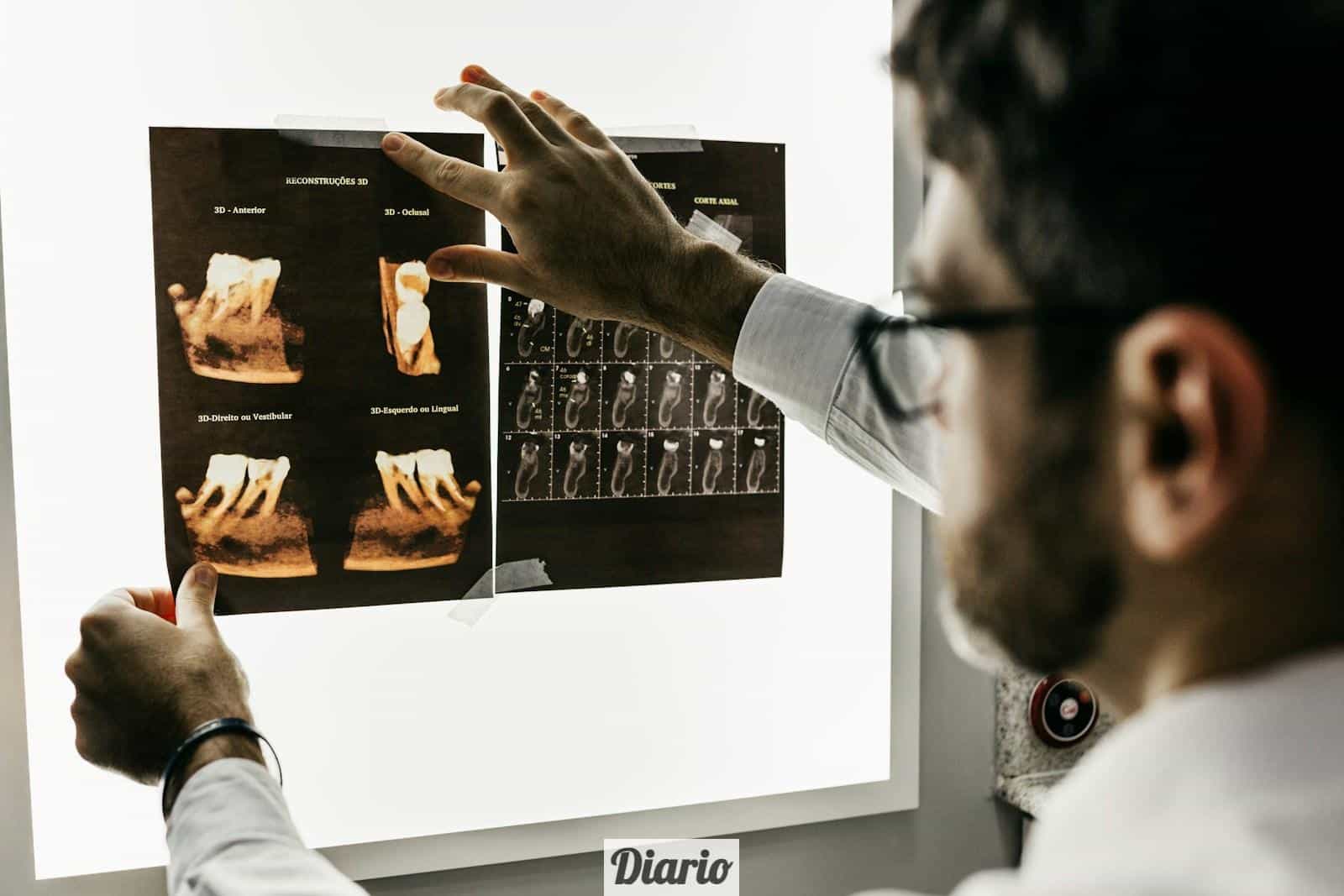 Top 3 Clínicas dentales para ponerte carillas dentales en Málaga