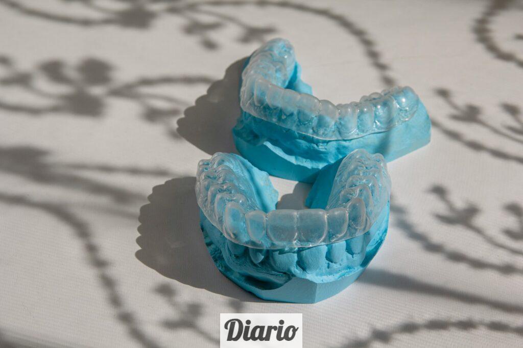 Guía para padres: ¿Es Invisalign Teen adecuado para mi hijo?