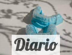 Guía para padres: ¿Es Invisalign Teen adecuado para mi hijo?