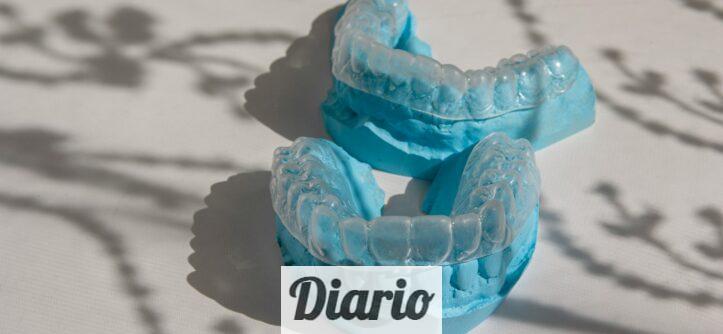 Guía para padres: ¿Es Invisalign Teen adecuado para mi hijo?