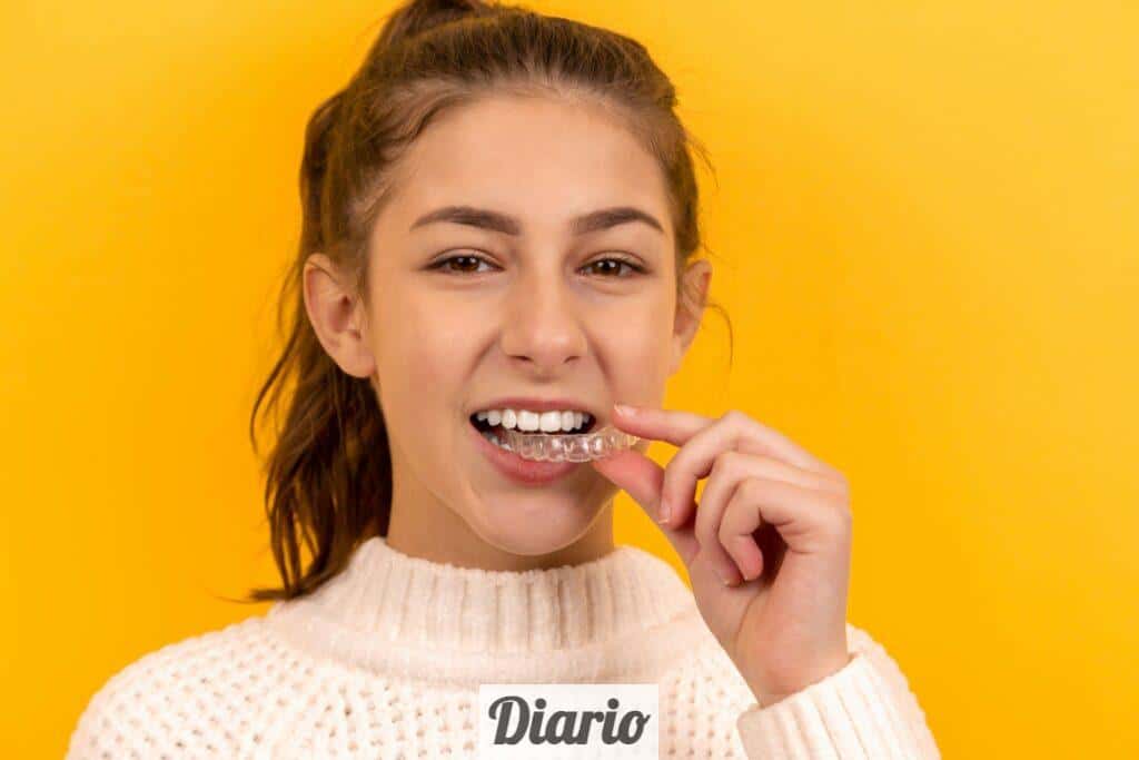 ¿Es Invisalign Teen adecuado para mi hijo?
